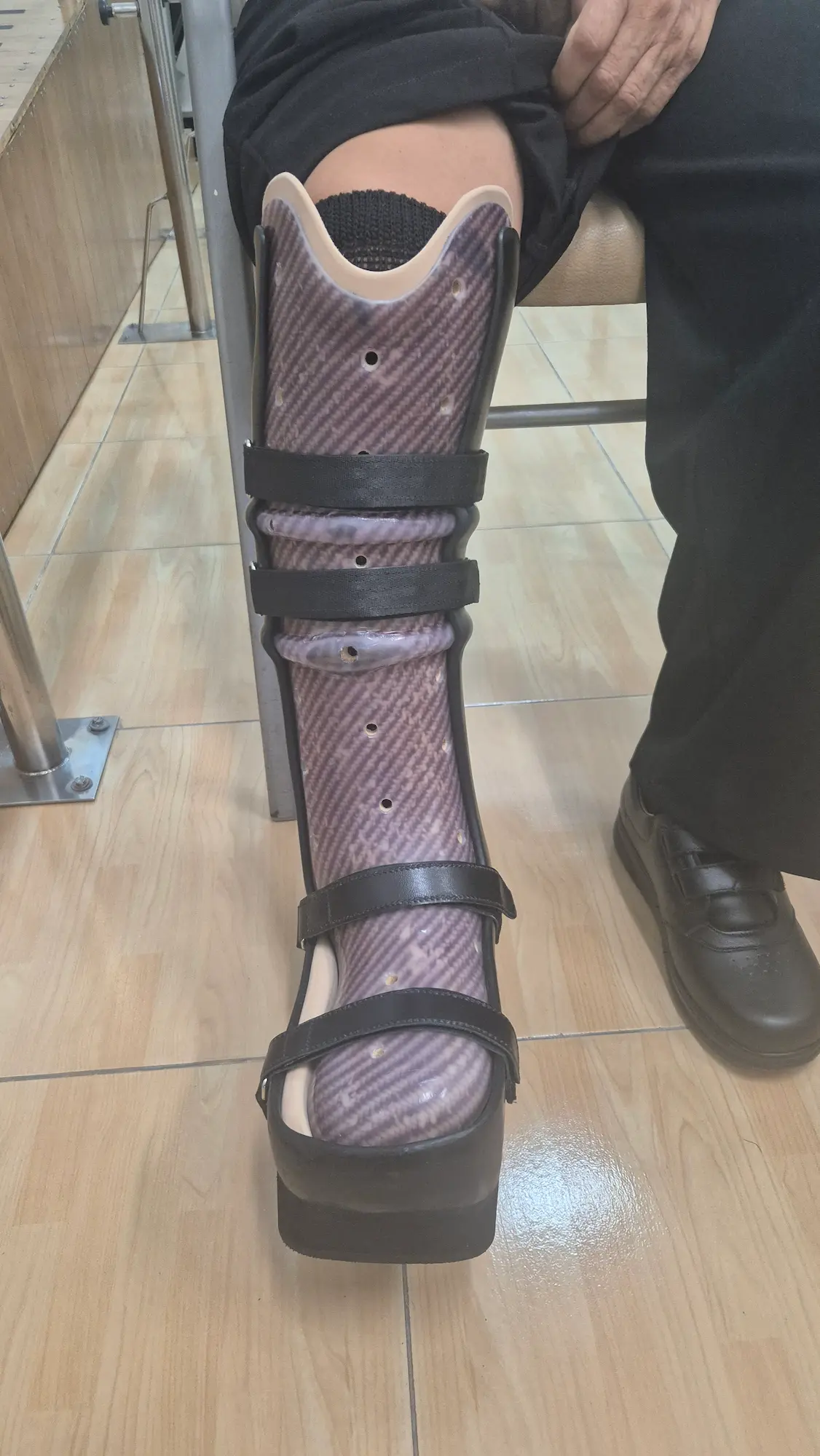 Bota de Charcot fabricada en Ortover